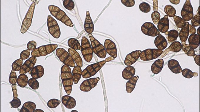 Hongo de la alternaria antes de ser tratado con septum